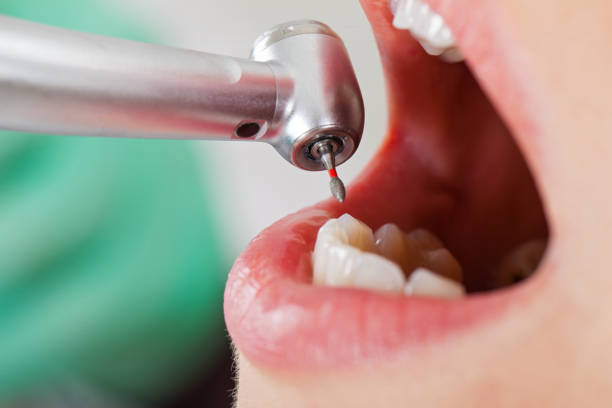 Best Pediatric Emergency Dentist in Tickfaw, LA